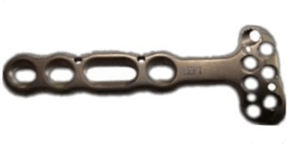 Distal Radius Volar LCP