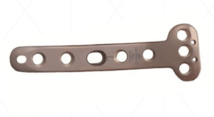 Locking Medial Proximal Tibial plate