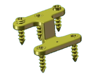 Calcaneal Facture Plate