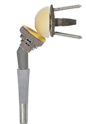 MIRAI® Modular Shoulder System